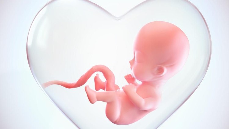 3D Ultrasound image