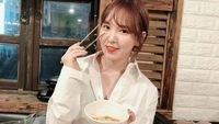 Wendy Red Velvet Jatuh dan Patah Tulang, Berapa Lama Penyembuhannya?