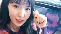 Wendy Red Velvet Patah Tulang, Ini Hal yang Dapat Menghambat Penyembuhan