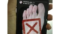 Sepatu Puluhan Juta Bikin Kaki Bella Shofie Lecet, Apa Penyebabnya?