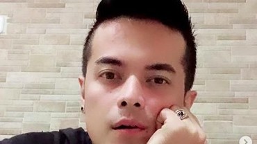 Choky Andriano Diduga Selingkuh dengan Intan Permata, Istri Lepas Cincin Kawin