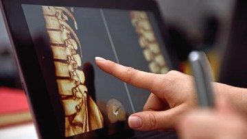 CARA CEGAH OSTEOPOROSIS