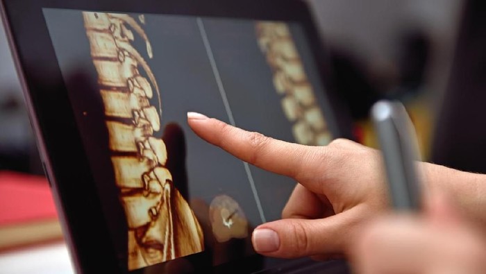 Hand pointing on screen with X-rays of the spine. close up