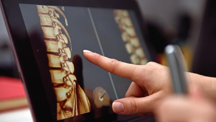 Hand pointing on screen with X-rays of the spine. close up