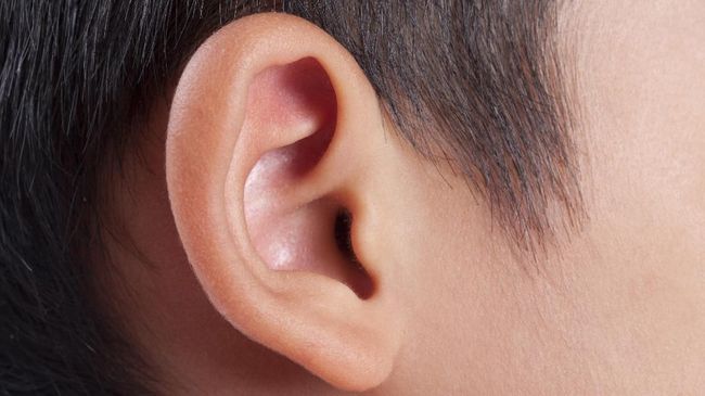Nama penyakit stroke kuping mencuat lantaran celoteh Kiky Saputri. Benarkah stroke kuping itu bisa terjadi?