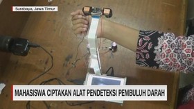 Mahasiswa Ciptakan Alat Pendeteksi Pembuluh Darah