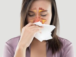 Mengenal Beberapa Metode Pengobatan untuk Sinusitis