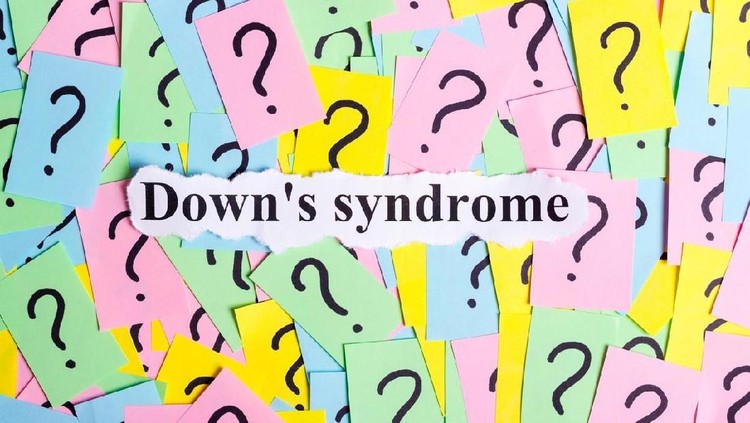 Down syndrome bisa terjadi pada siapa saja. Bunda, yuk cari tahu bersama upaya mencegahnya.