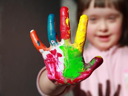 Berkenalan Lebih Dekat dengan Down Syndrome