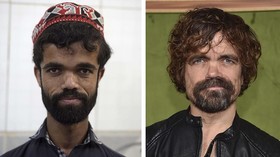 FOTO: Hari-hari Rozi Khan, 'Tyrion Lannister' dari Pakistan