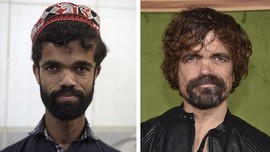 FOTO: Hari-hari Rozi Khan, 'Tyrion Lannister' dari Pakistan