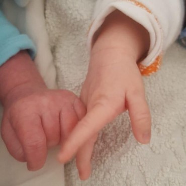 Aneh, Ibu Lahirkan Anak Kembar dari 2 Ayah yang Berbeda