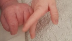 Aneh, Ibu Lahirkan Anak Kembar dari 2 Ayah yang Berbeda