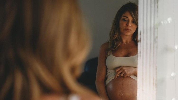 ilustrasi stretch mark
