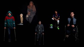 FOTO: Kaki Palsu untuk Mereka yang Terluka di Jalur Gaza