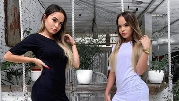 Bibir The Connell Twins Jadi Sorotan, Sosok Lucinta Luna Ikut Terseret