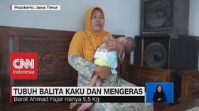 VIDEO: Memprihatinkan! Tubuh Balita 4 Tahun Ini Kaku
