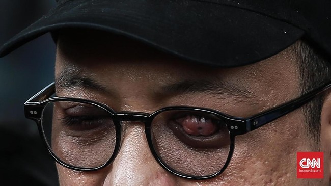 Novel mengatakan masih menunggu proses hukum selanjutnya setelah polisi berhasil menangkap dua pelaku penyiraman air keras kepada dirinya.