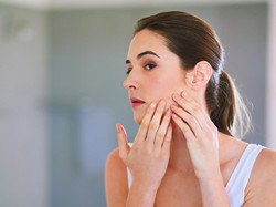 Azelaic Acid, Skincare Jerawat yang Lebih Aman Dibanding Benzoyl Peroxide
