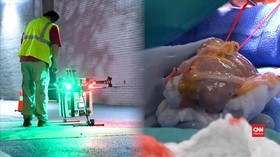 VIDEO: Dengan <i>Drone</i>, Transplantasi Organ Lebih Cepat