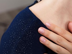 6 Penyebab Ketombe yang Menyebabkan Rasa Gatal