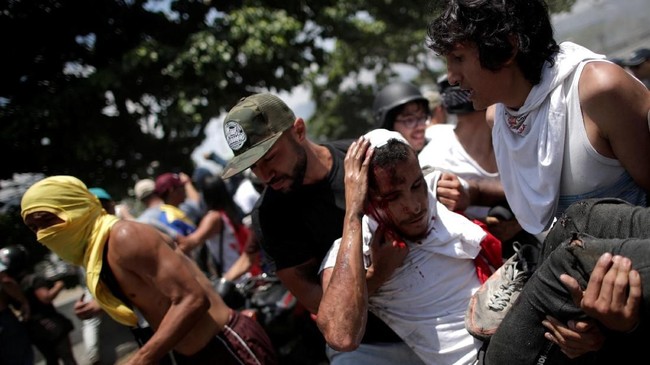 Sebanyak 46 orang terluka dalam bentrokan antara aparat keamanan dan massa anti pemerintah di Venezuela saat Hari Buruh pada Rabu (1/5).
