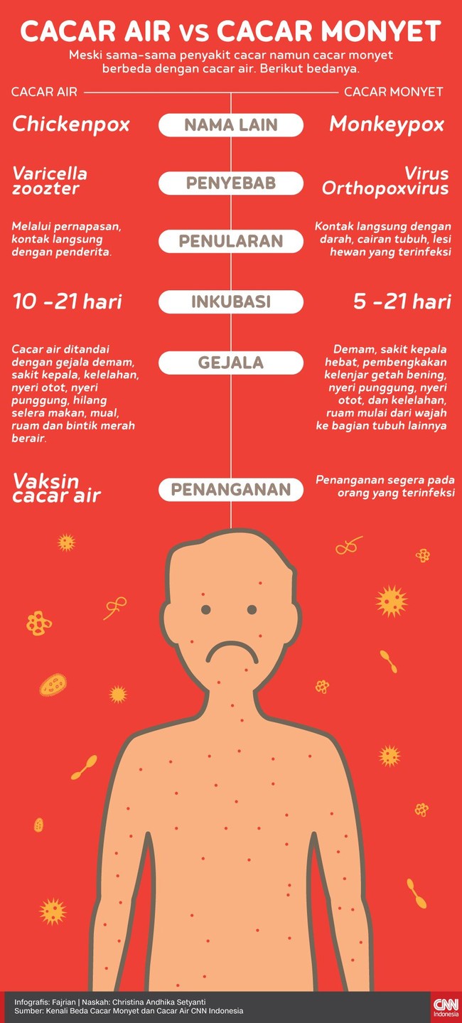 Meski sama-sama penyakit cacar namun cacar monyet berbeda dengan cacar air. Berikut bedanya.