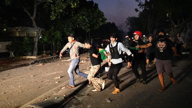 Korban terkena tembakan peluru karet aparat pada bagian kaki yang satunya kena peluru karet di lengan kanan