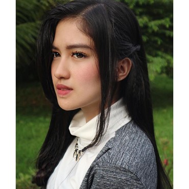 Ochi Rosdiana Kena Kotoran Burung, Netizen: Situ Kate Middleton?