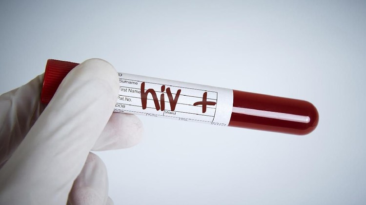 Laboratory Request, Hiv Test, Hiv Positive