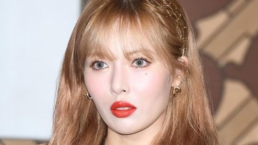 Insiden Memalukan 3 Artis Cantik Korea