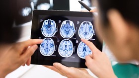 Kisah William Bertahan Hidup dengan Alzheimer