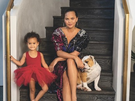 Chrissy Teigen Dikritik Saat Ajak Anak ke Dokter Gigi