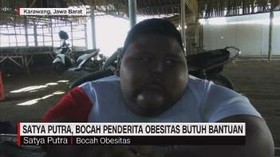 VIDEO: Satya Putra, Bocah Penderita Obesitas Butuh Bantuan