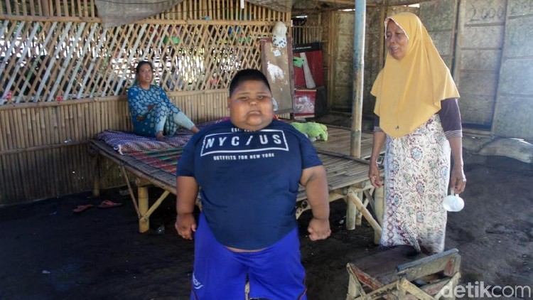 Satia Putra (7) meninggal dunia karena obesitas. Ini yang mesti Bunda tahu soal cara mencegah obesitas pada anak.