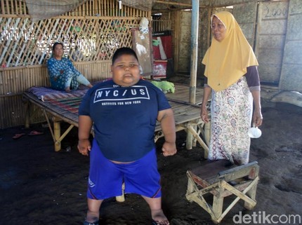 Belajar dari Satia Putra, Obesitas Bisa Ancam Nyawa Anak