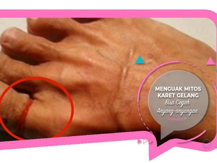 Menguak Mitos Karet Gelang Bisa Cegah Anyang-anyangan