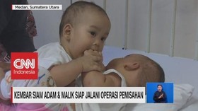 VIDEO: Kembar Siam Adam & Malik Siap Jalani Operasi Pemisahan