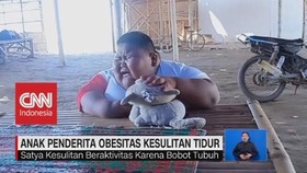 VIDEO: Kasihan, Anak Penderita Obesitas Ini Kesulitan Tidur
