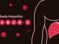 INFOGRAFIS: Beda Hepatitis A, B, C, D, dan E