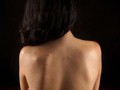 7 Cara Ampuh Atasi Jerawat Punggung