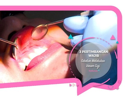 3 Pertimbangan Wajib Sebelum Melakukan Veneer Gigi