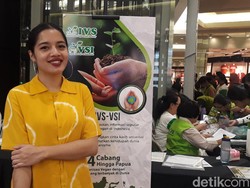 Cantika Abigail Unggah Foto Diri saat Psoriasis