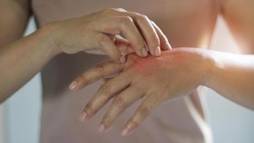 4 Kebiasaan yang Bikin Kulit Jadi Kering, Mandi Pakai Air Hangat
