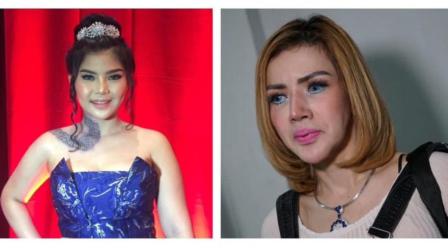 Netizen Jahat, Suara Meldi Dianggap Cocok Duet dengan Barbie Kumalasari Rosa Meldianti melakukan operasi pita suara.