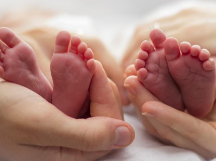 Kisah Persiapan Operasi Pemisahan Bayi Kembar Siam Aqila & Azila