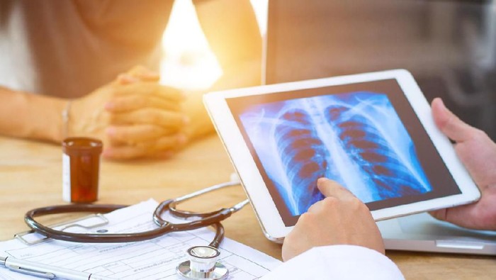 Doctor shows results to old patient x-ray of the lungs, smoking cigarettes problem
