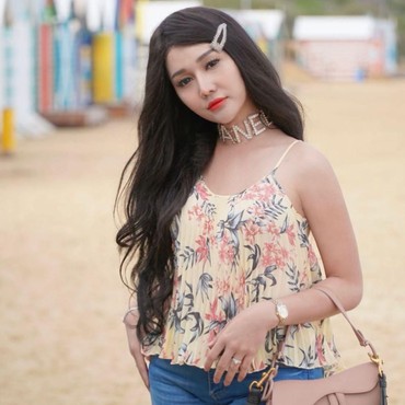 Cerita Lucinta Luna Operasi Bokong: 7 Hari Harus Tengkurap