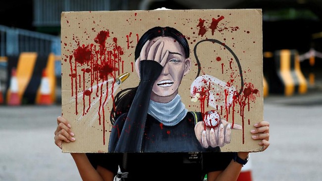 KJRI Hong Kong menyatakan jurnalis WNI yang terkena peluru karet saat meliput demo kini sudah dipindahkan dari ruang rawat intensif ke ruang rawat inap.