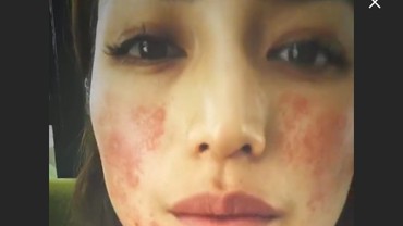 img-title Berubah Drastis, Ada Apa dengan Wajah Jessica Iskandar?